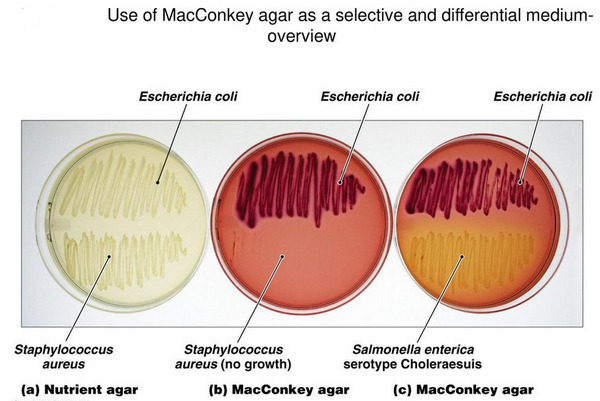 MacConkey agar selective and differential medium