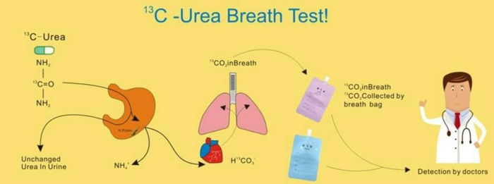 urea breath test