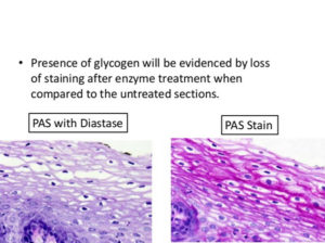 PAS stain