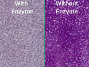 Two PAS Stain procedure with and without enzyme