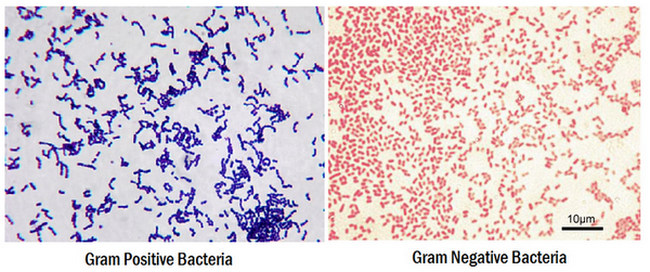 gram stain procedure gran negative positive bacteria