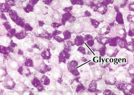 positive polysaccharide result - glycogen