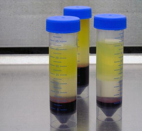 samples contain fresh human blood buffy coat